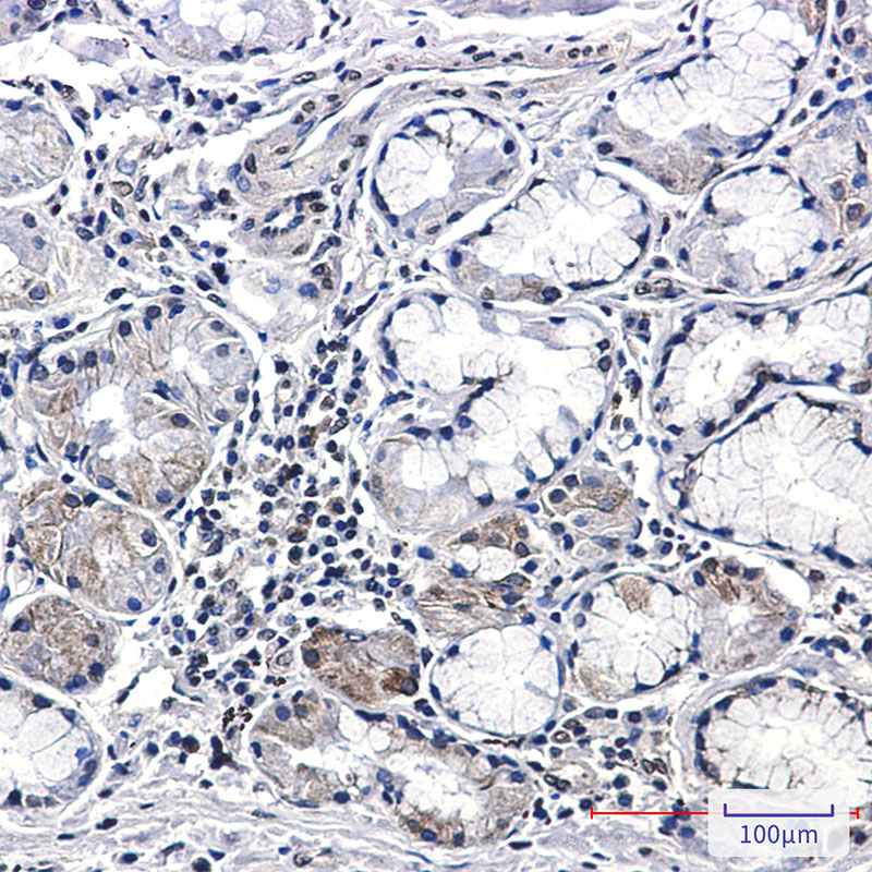CSDE1 Rabbit mAb